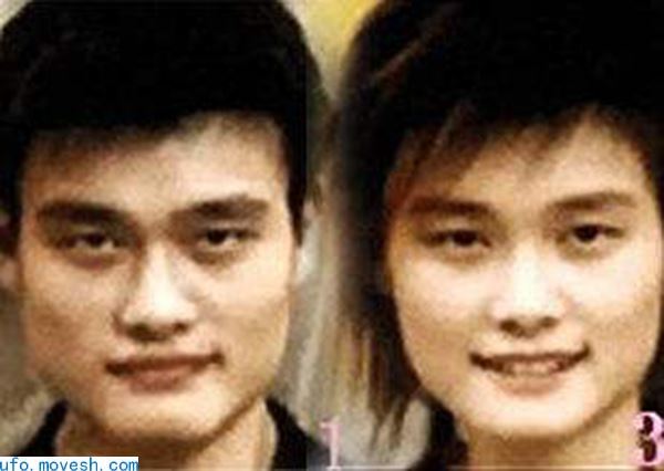 脸盲证是什么引起的